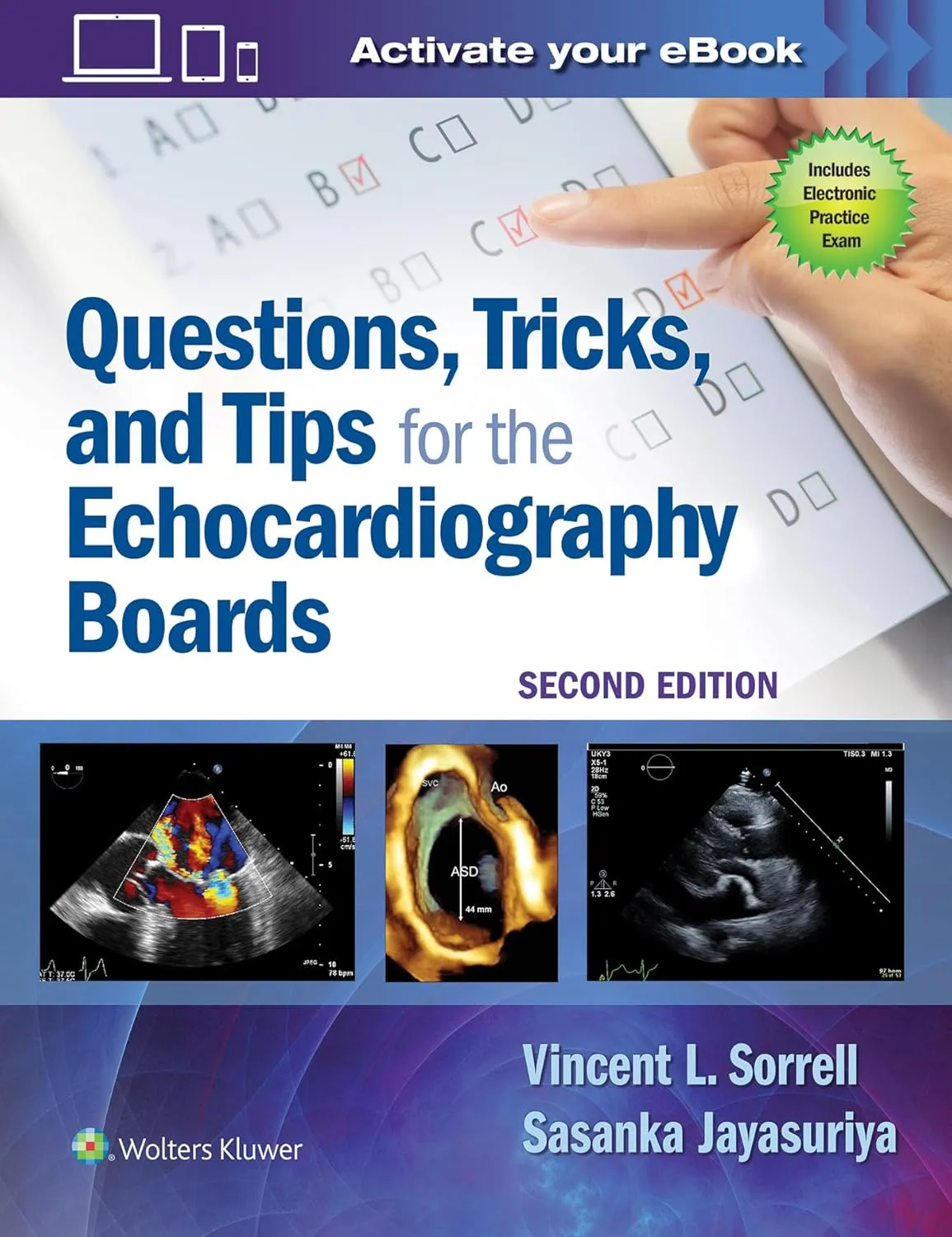 Questions | Tricks | and Tips Echocardiography Boards | 2nd Edition | Paperback