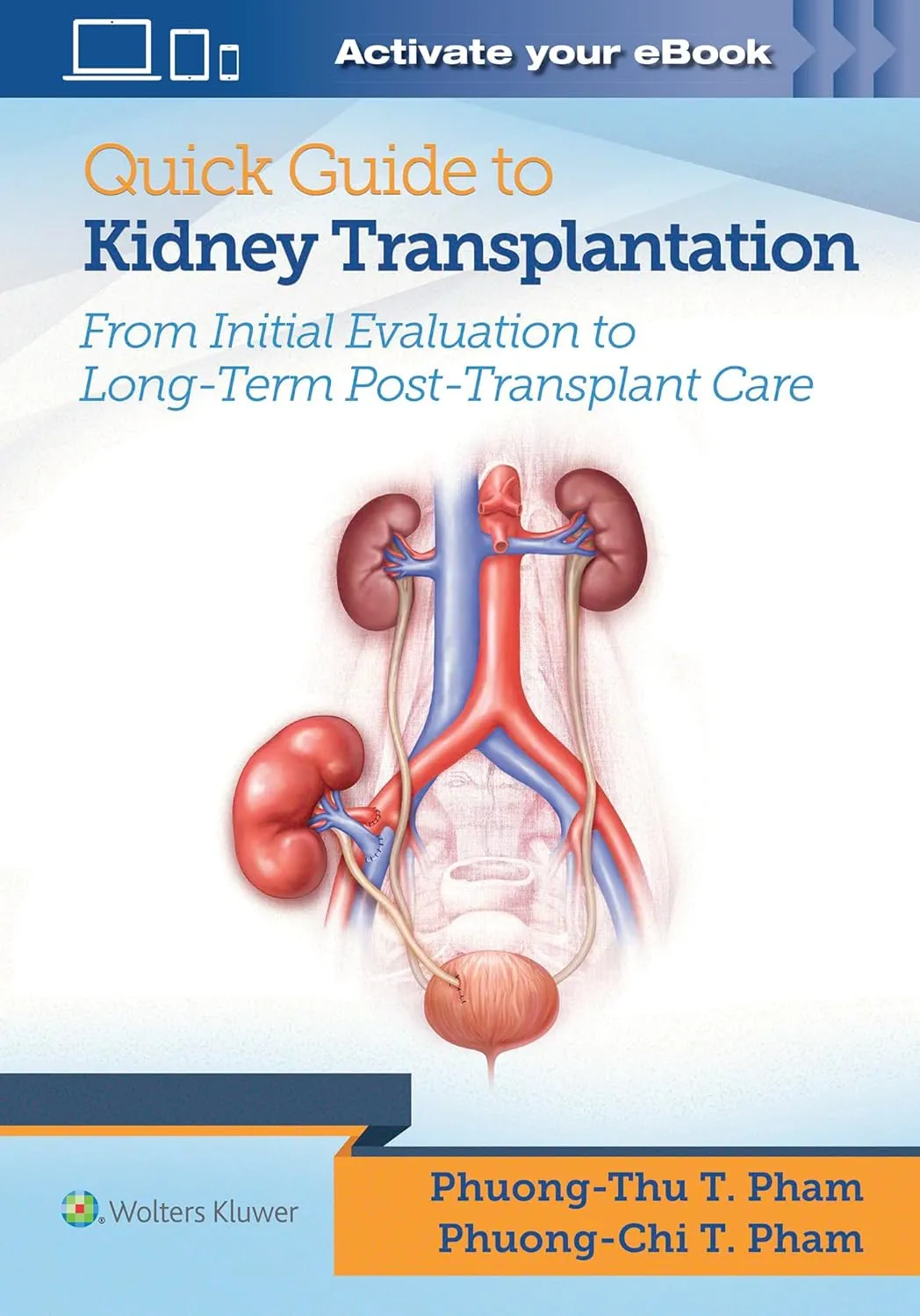 Quick Guide to Kidney Transplantation  From Intitial Evaluation to Long-Term Post-Transplant Care | Paperback