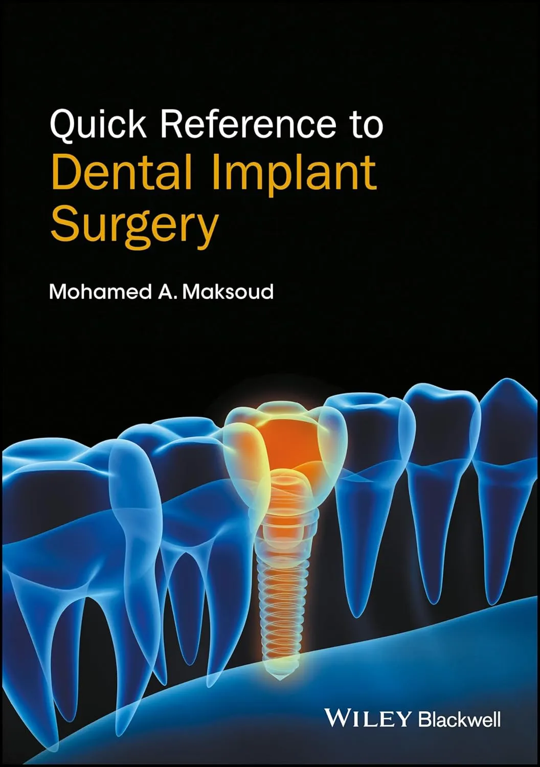Quick Reference to Dental Implant Surgery | Paperback