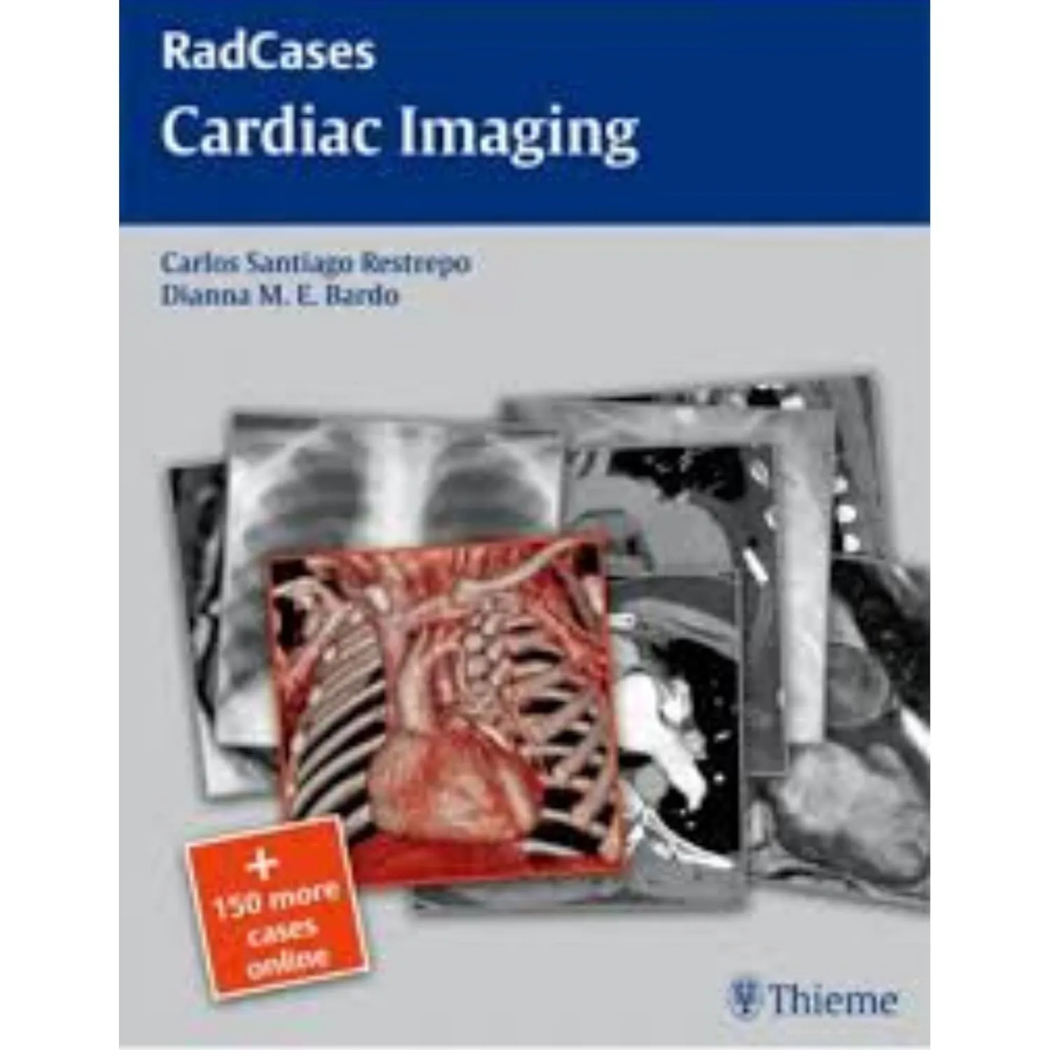 RadCases Cardiac Imaging