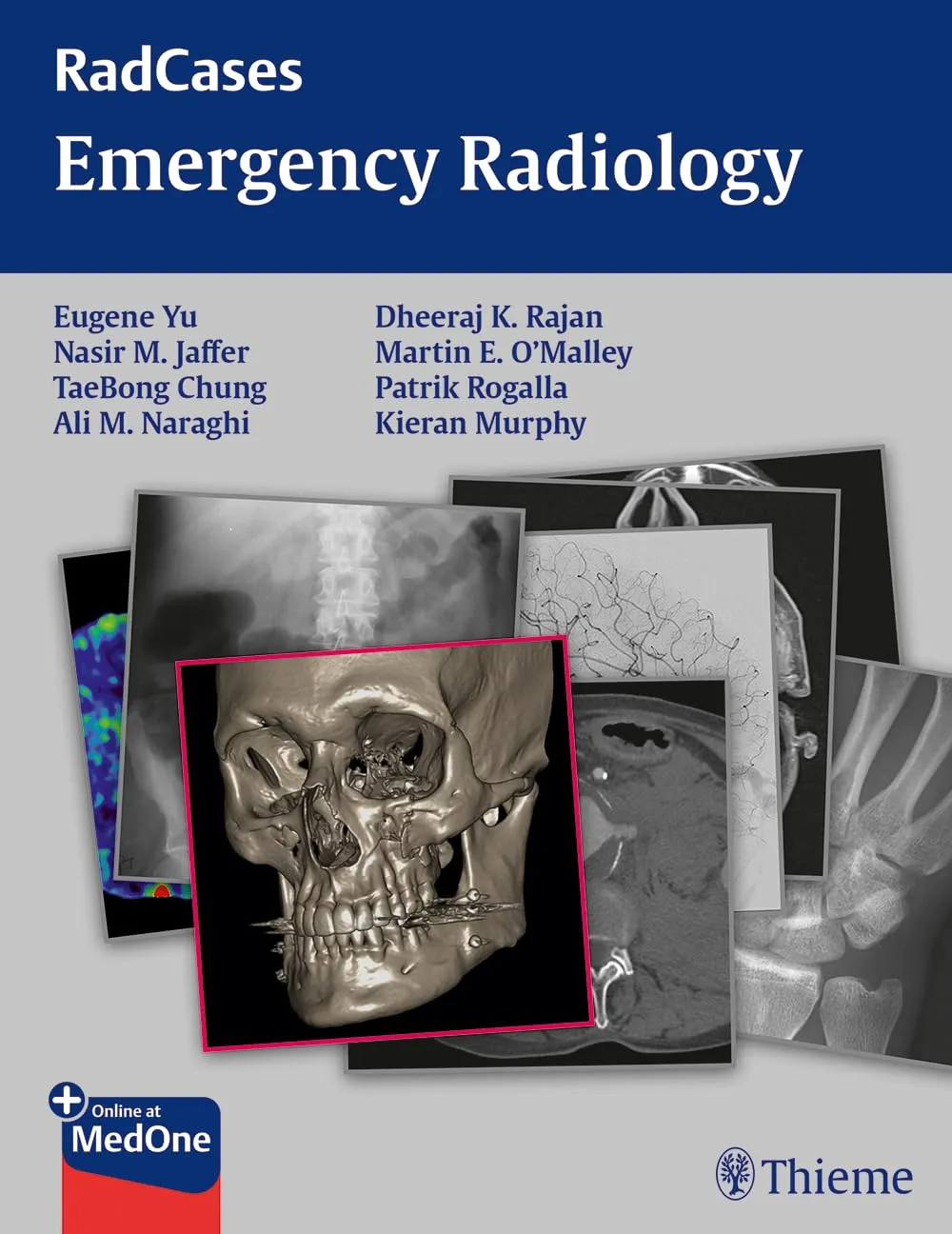 RadCases Emergency Radiology | Paperback