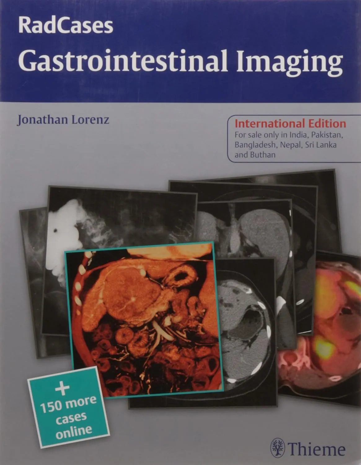 RadCases Gastrointestinal Imaging | Paperback