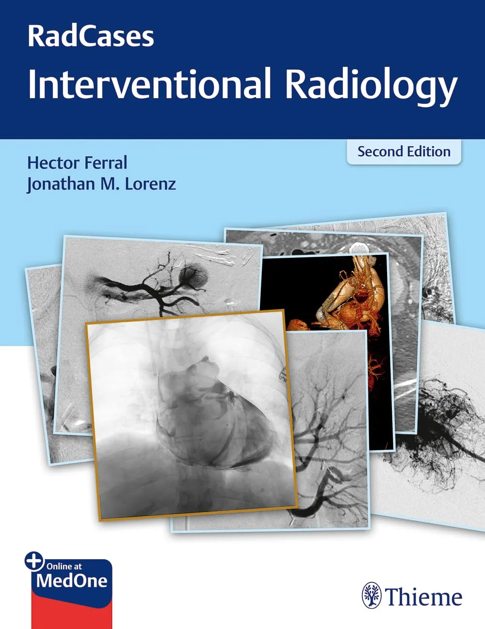 RadCases Interventional Radiology | 2nd Edition | Paperback