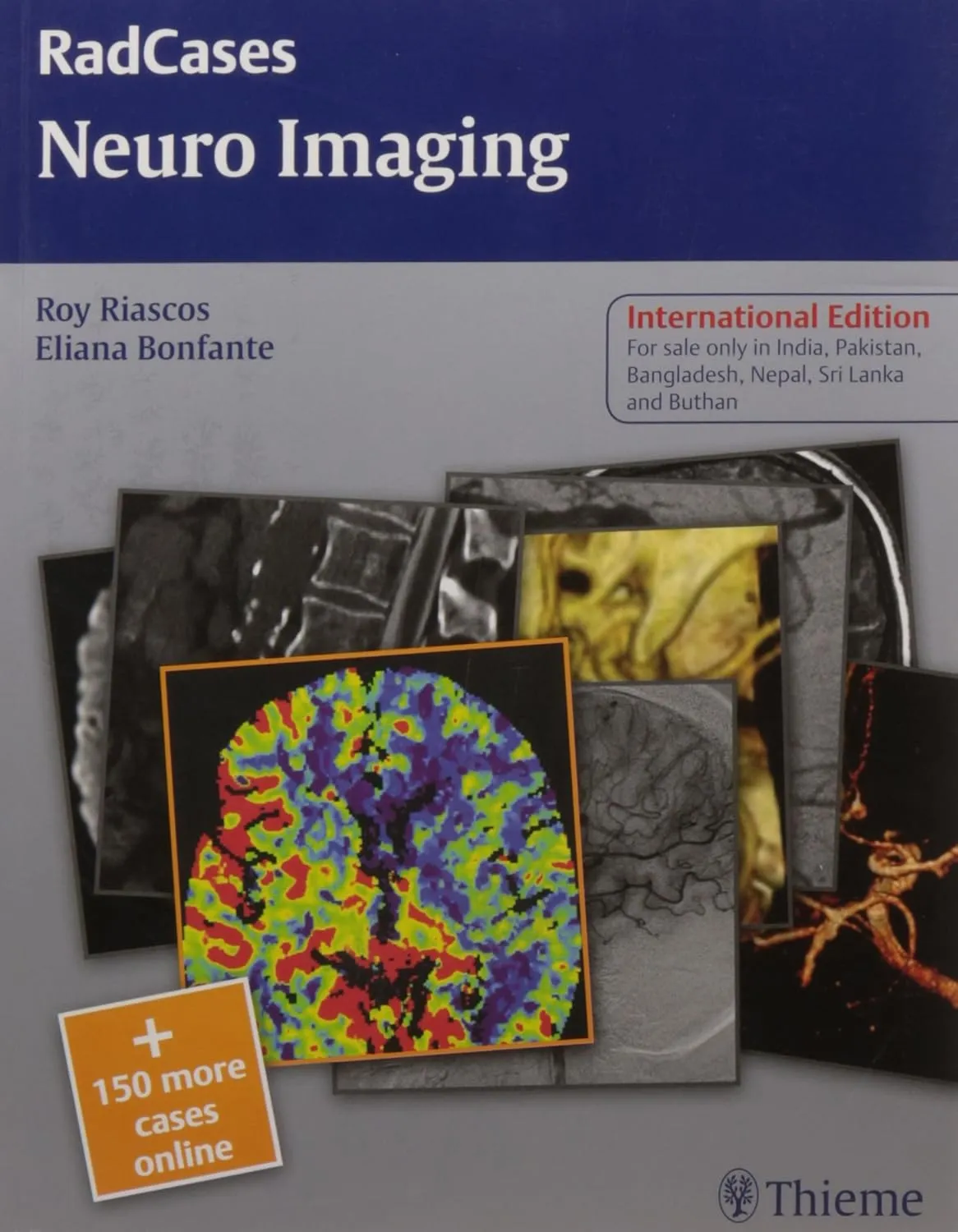 RadCases Neuro Imaing | Paperback