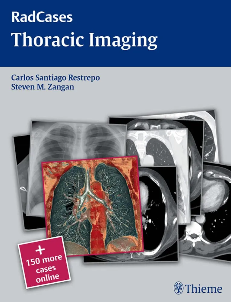 RadCases Thoracic Imaging | Paperback