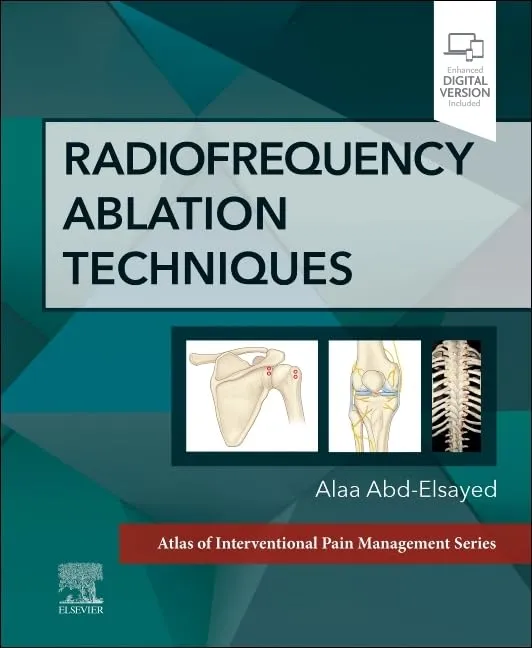 Radiofrequency Ablation Techniques With Access Code | Hardcover