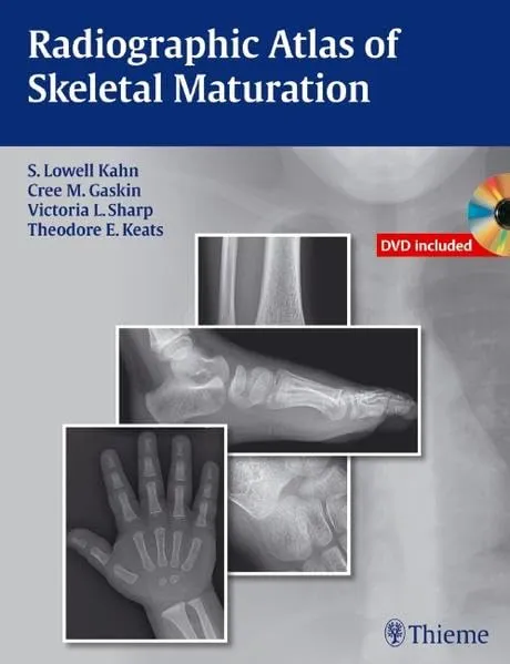 Radiographic Atlas of Skeletal Maturation | With DVD | Hardcover