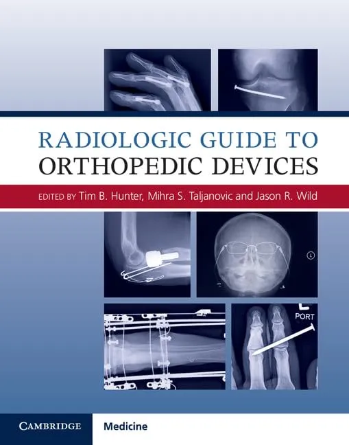 Radiologic Guide to Orthopedic Devices | Hardcover