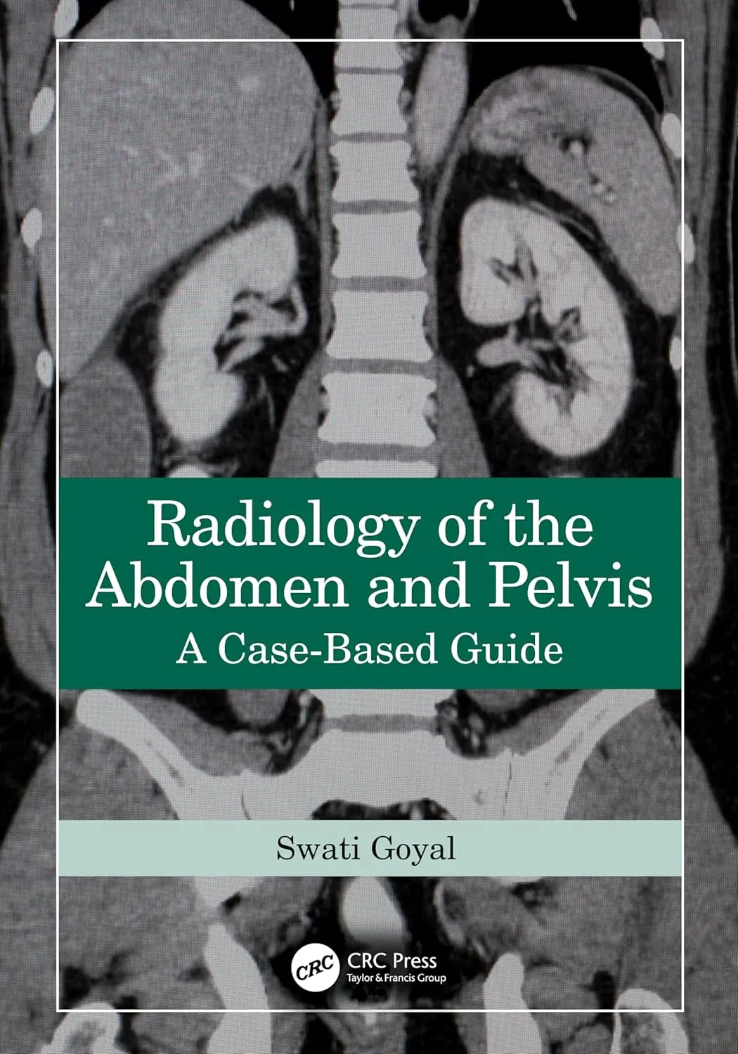 Radiology Of The Abdomen And Pelvis A Case Based Guide | Paperback