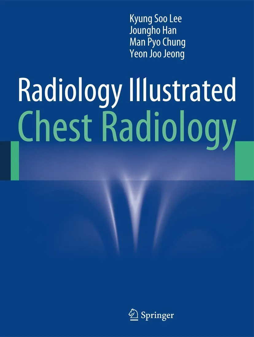 Radiology Illustrated Chest Radiology | Hardcover