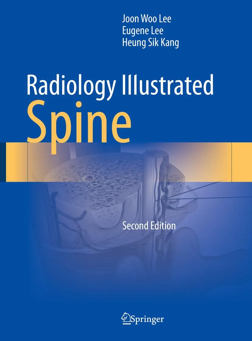 Radiology Illustrated Spine 2nd Edition | Hardcover