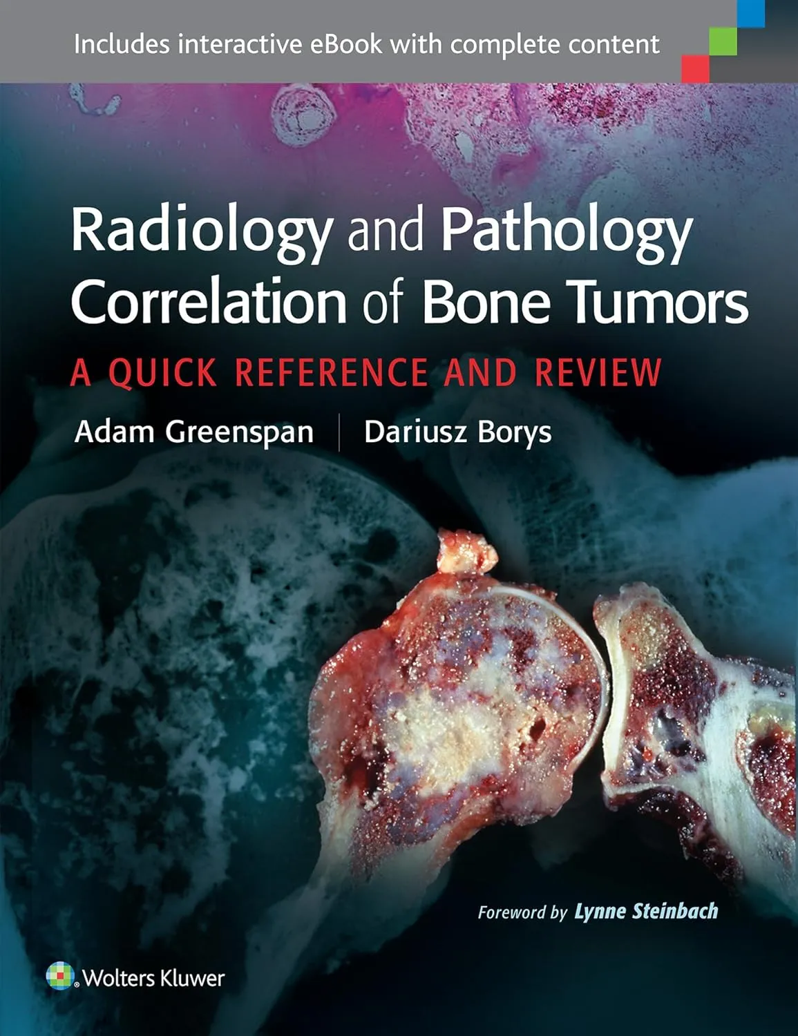Radiology and Pathology Correlation of Bone Tumors | Hardcover