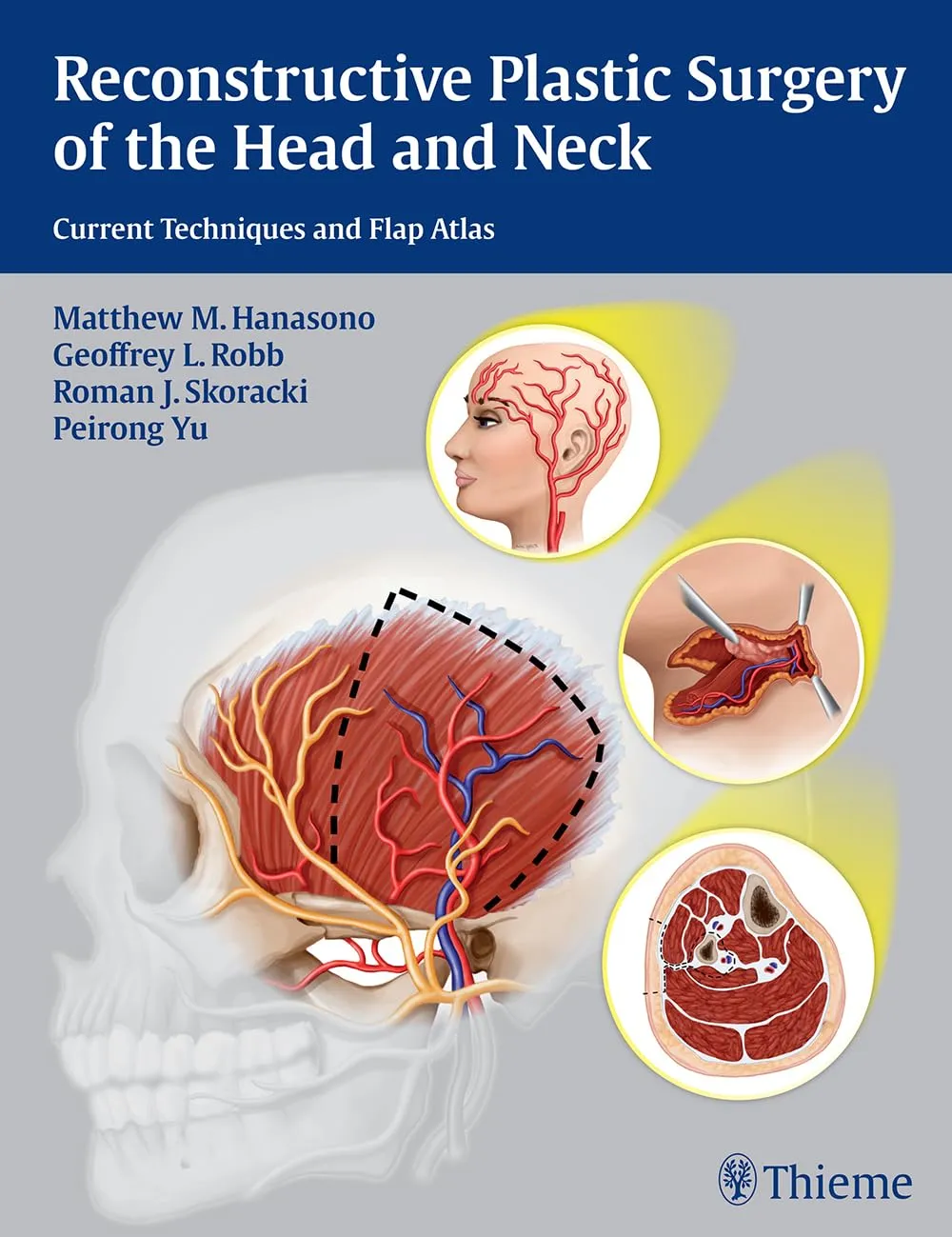 Reconstructive Plastic Surgery of the Head and Neck | Paperback