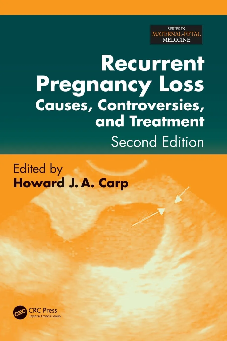 Recurrent Pregnancy Loss Causes | Controversies | and Treatment | 2nd Edition | Hardcover