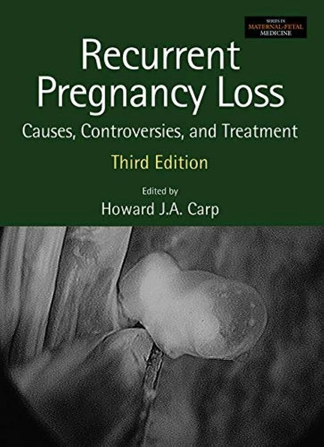 Recurrent Pregnancy Loss Causes Controversies and Treatment | Third Edition | Hardcover