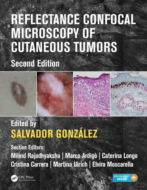 Reflectance Confocal Microscopy of Cutaneous Tumors | 2nd Edition | Hardcover