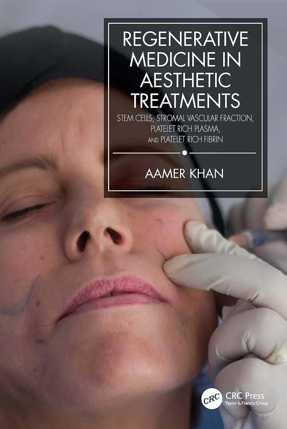 Regenerative Medicine In Aesthetic Treatments Stem Cells Stromal Vascular Fraction Platelet Rich Plasma and Platelet Rich Fibrin | Hardcover