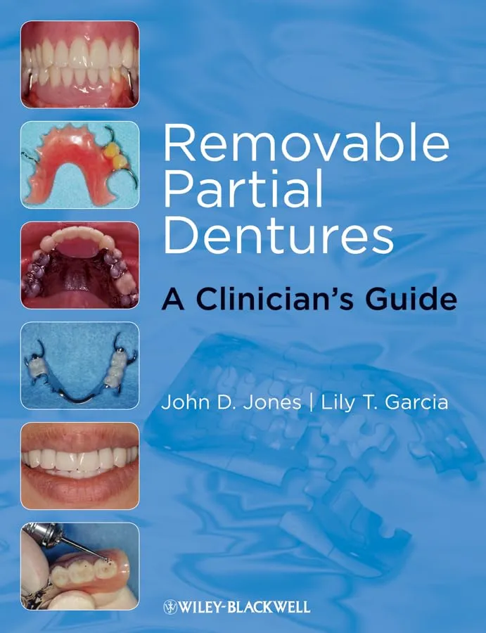 Removable Partial Dentures A Clinician's Guide | Paperback
