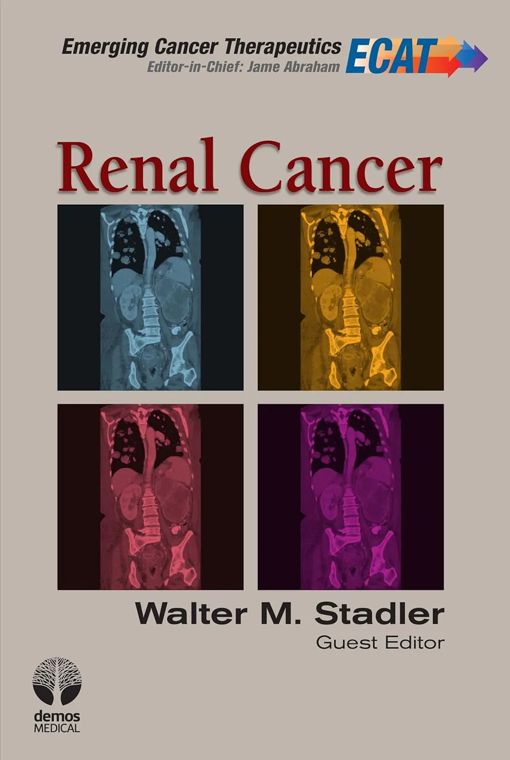 Renal Cancer | Hardcover