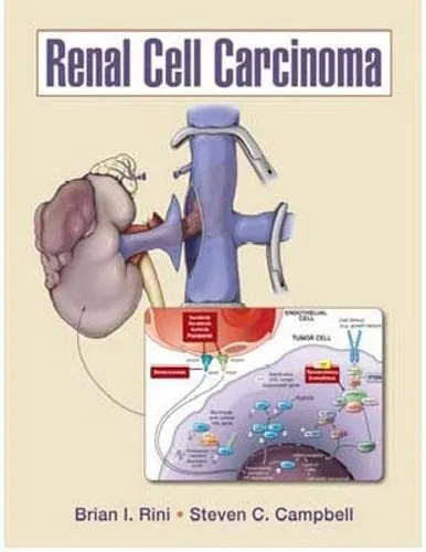 Renal Cell Carcinoma | Hardcover
