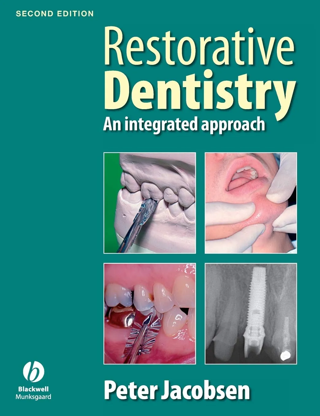 Restorative Dentistry An Integrated Approach | 2nd Edition | Paperback