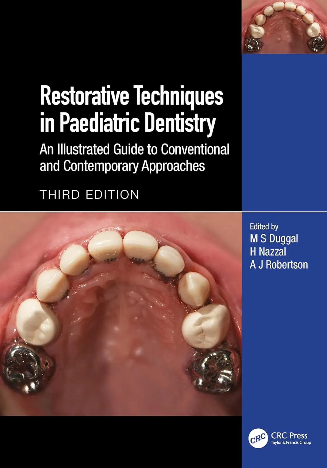 Restorative Techniques In Paediatric Dentistry An Illustrated Guide To Conventional And Contemporary Approaches Third Editiond | Hardcover