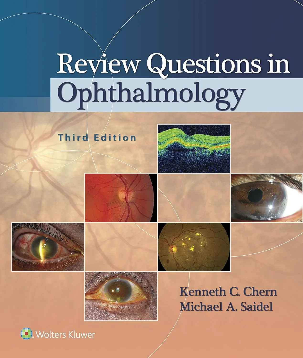 Review Questions in Ophthalmology | Third Edition | Paperback