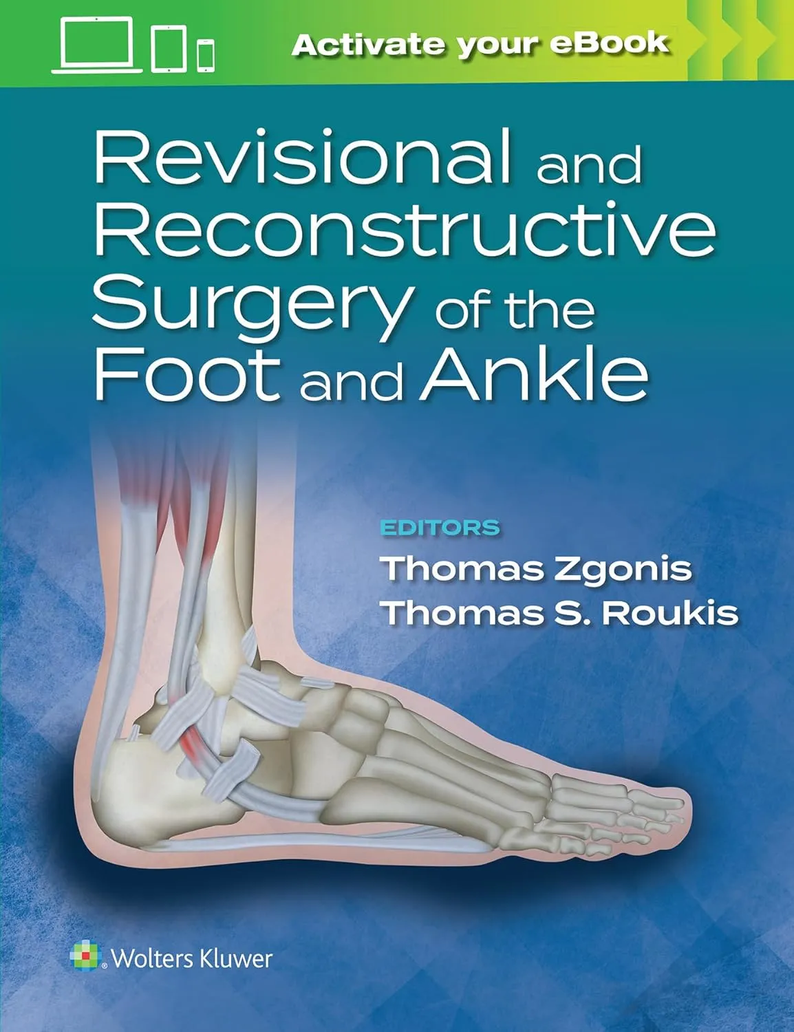 Revisional And Reconstructive Surgery Of The Foot And Ankle With Access Code | Hardcover