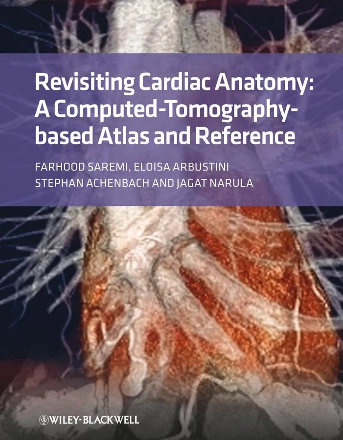 Revisiting Cardiac Anatomy A Computed-Tomography-Based Atlas and Reference | Hardcover