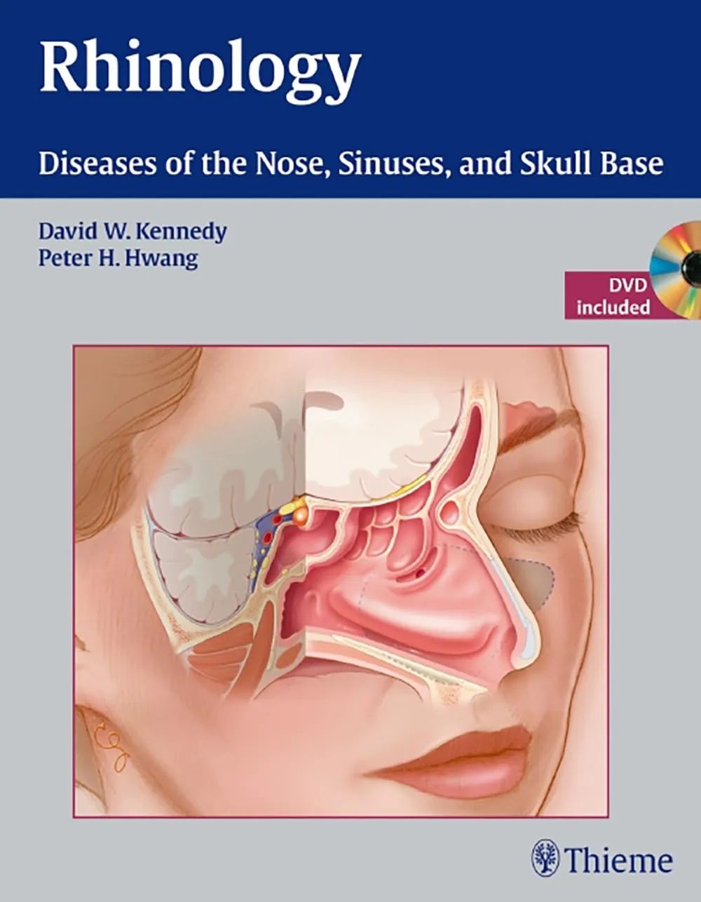 Rhinology Diseases of the Nose | Sinuses | and Skull Base | With DVD | Hardcover