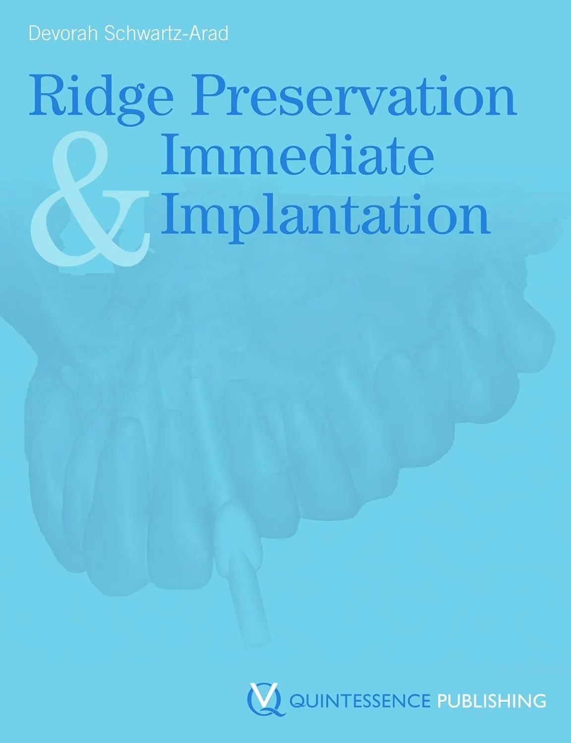 Ridge Preservation and Immediate Implantation | Hardcover