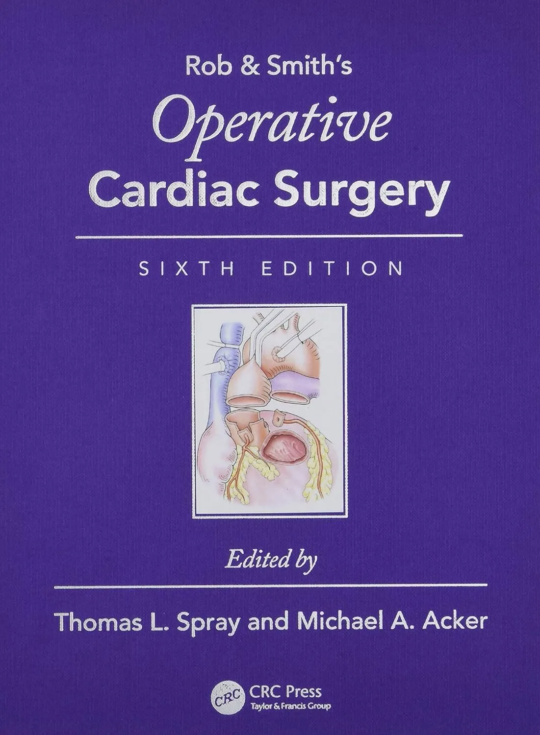 Rob and Smith's Operative Cardiac Surgery | 6th Edition | Hardcover