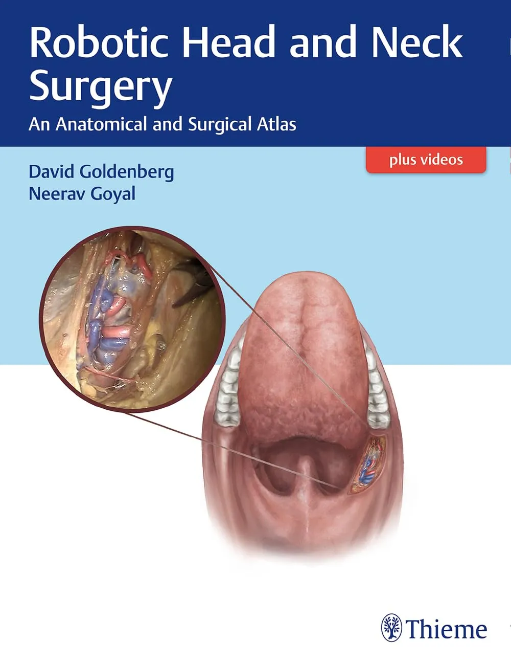 Robotic Head and Neck Surgery | Paperback