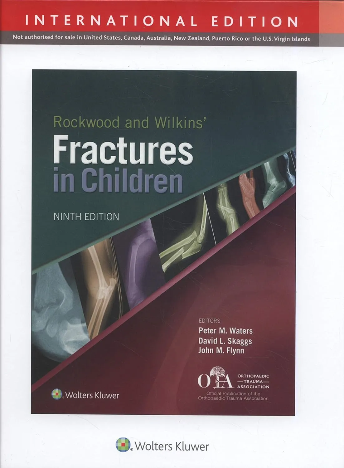 Rockwood and Wilkins Fractures In Children 9e (Ie) | Hardcover