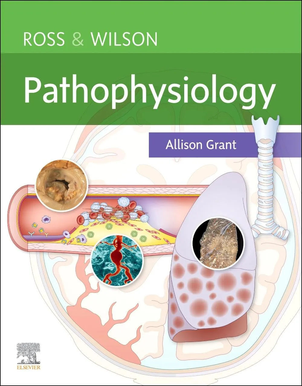 Ross And Wilson Pathophysiology | Paperback
