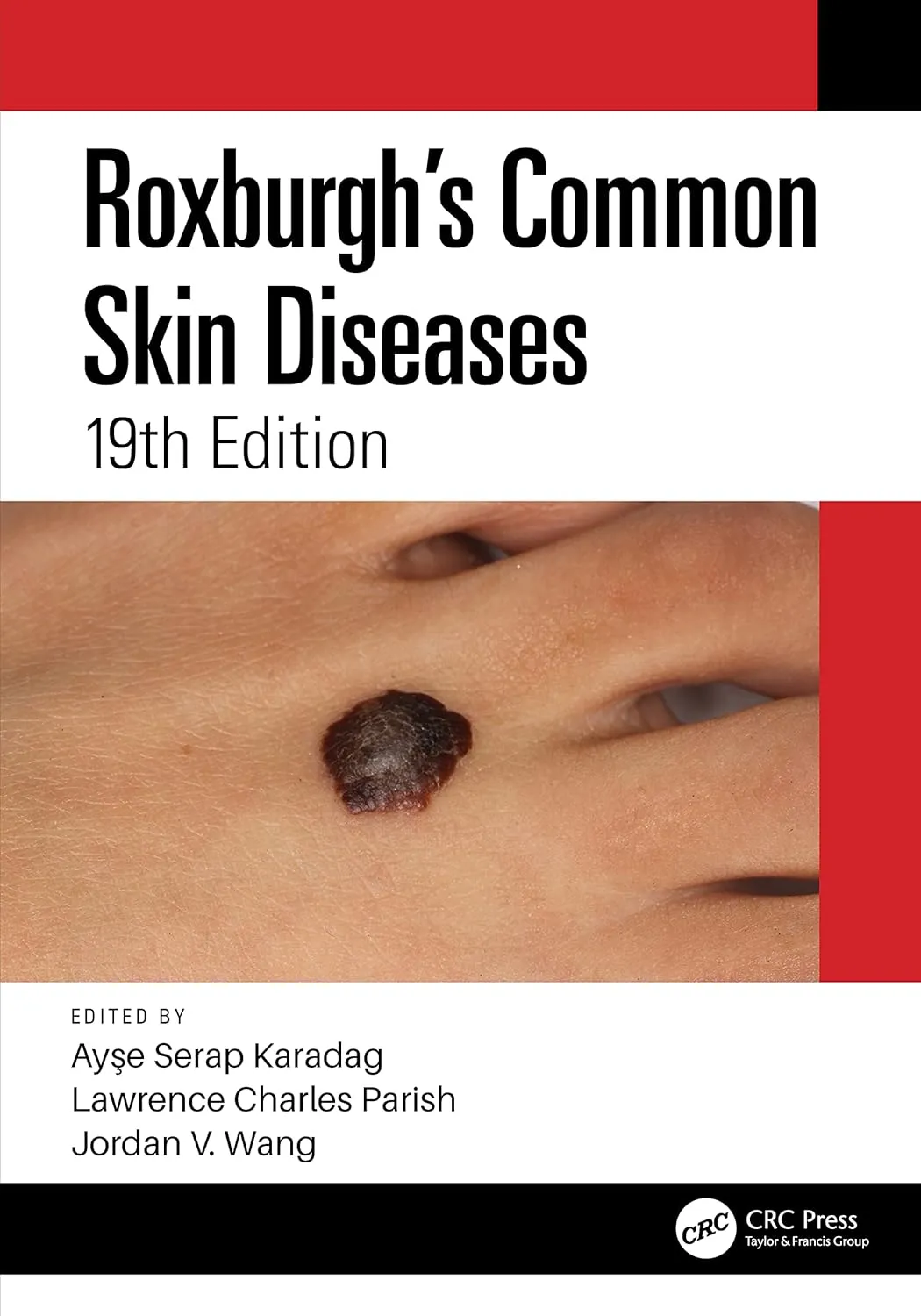 Roxburghs Common Skin Diseases 19e | Paperback
