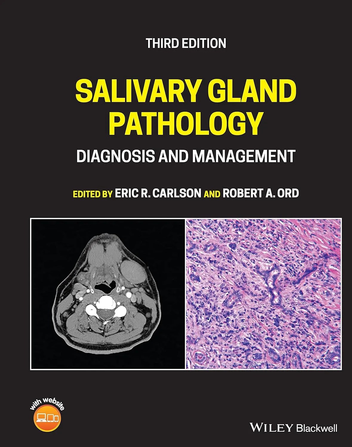 Salivary Gland Pathology Diagnosis And Management Third Edition | Hardcover