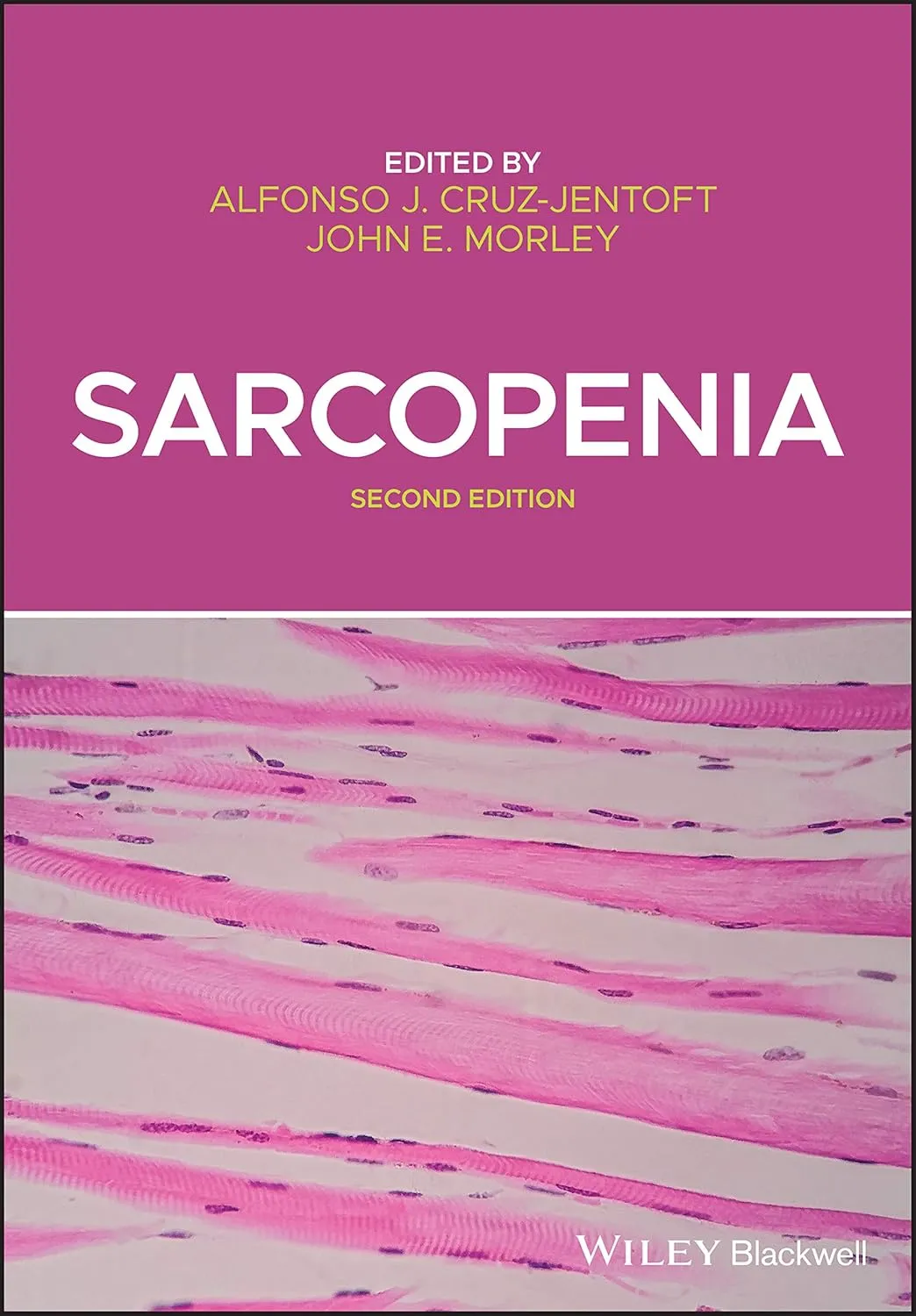 Sarcopenia 2nd Edition | Hardcover