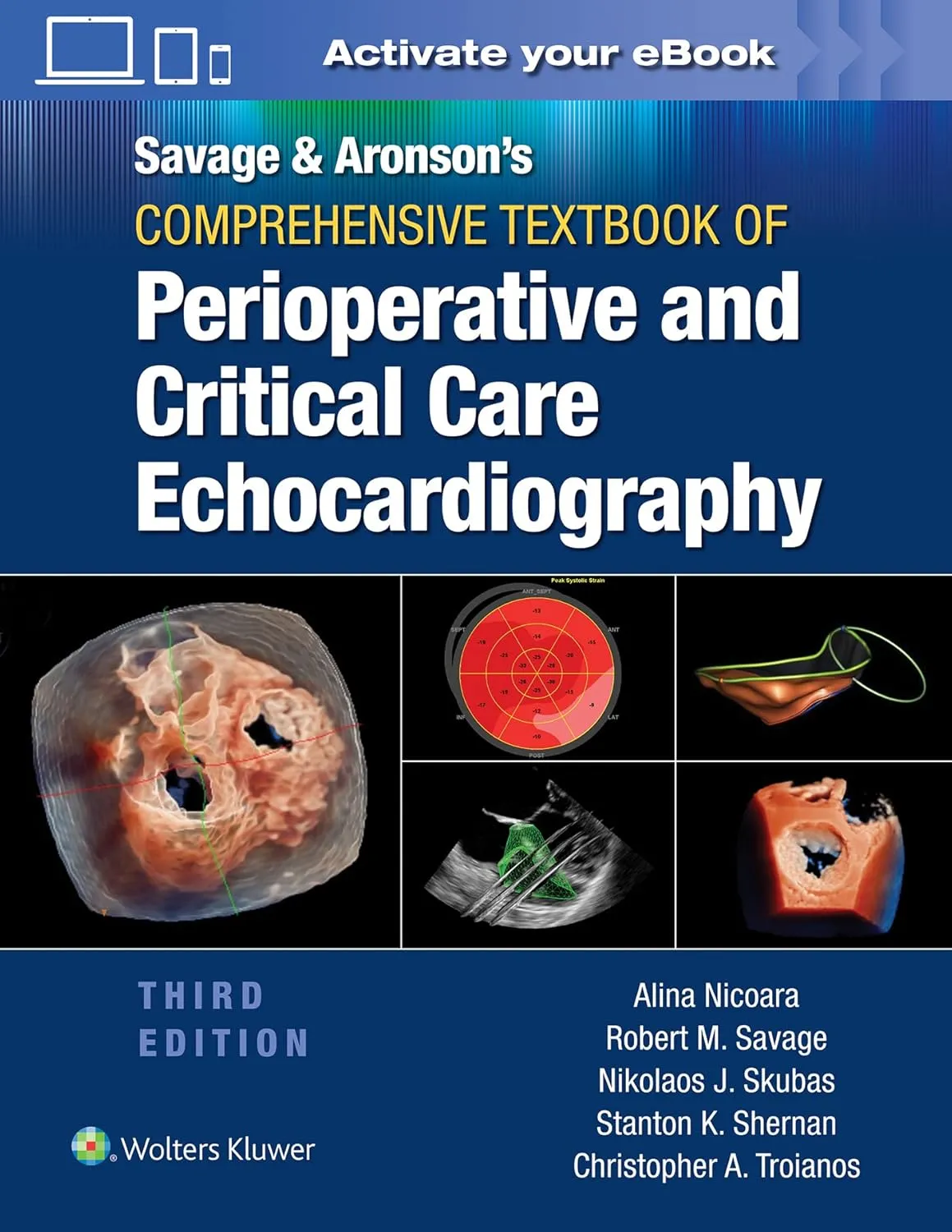 Savage And Aronsons Comprehensive Textbook Of Perioperative And Critical Care Echocardiography With Access Code Third Edition | Hardcover