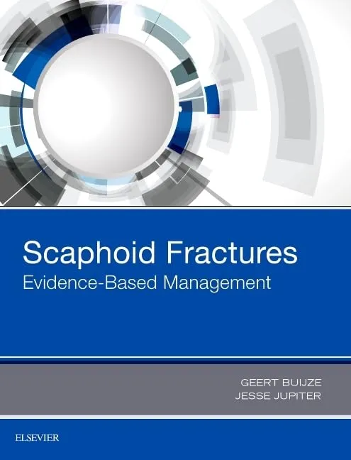 Scaphoid Fractures Evidence-Based Management | Hardcover