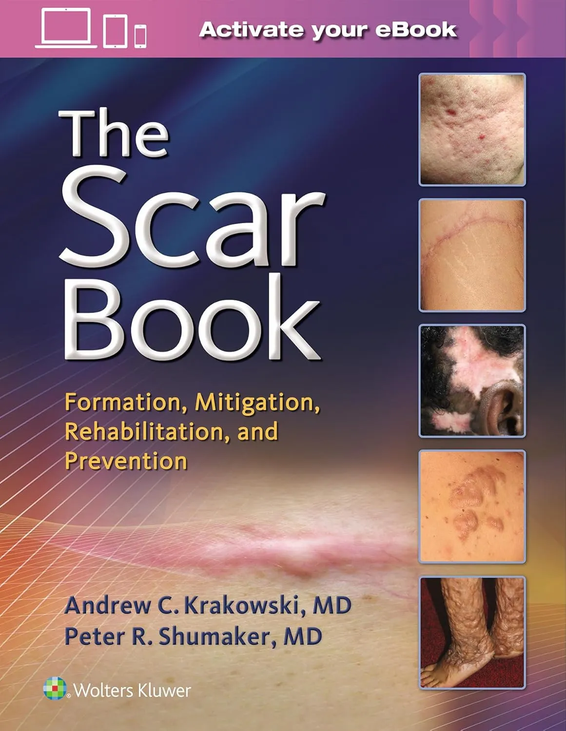 The Scar Book Formation | Mitigation | Rehabiliation | and Prevention | Hardcover