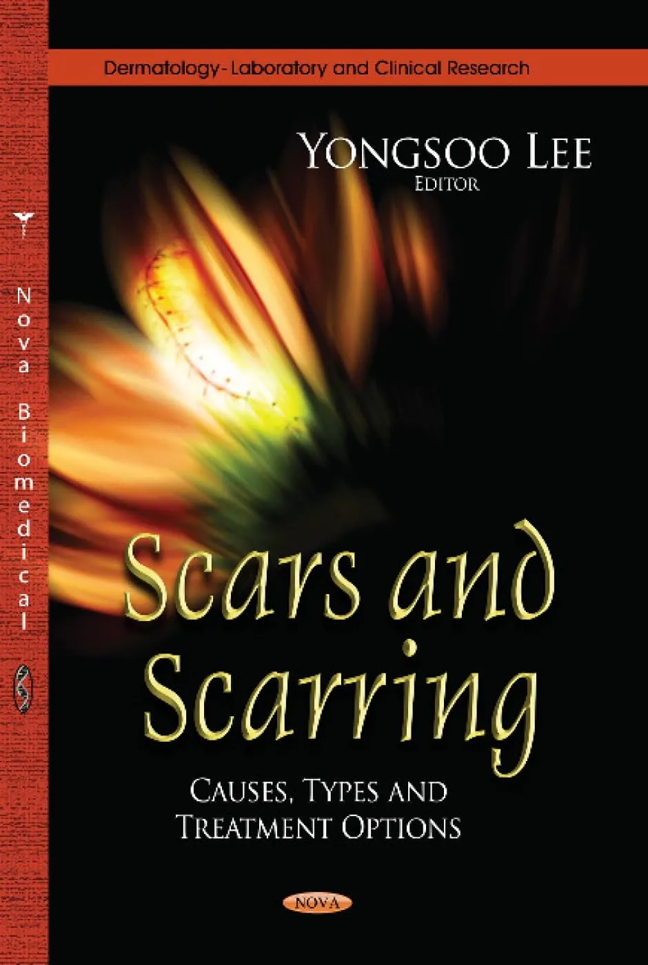 Scars and Scarring Causes | Types and Treatment Options | Hardcover