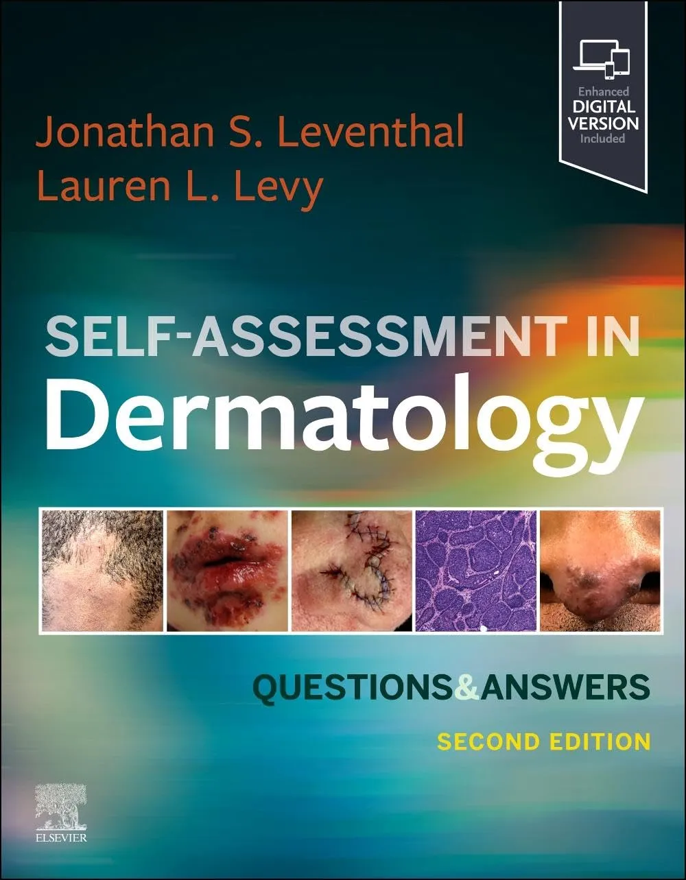 Self Assessment In Dermatology Questions And Answers With Access Code 2nd Editiond | Paperback