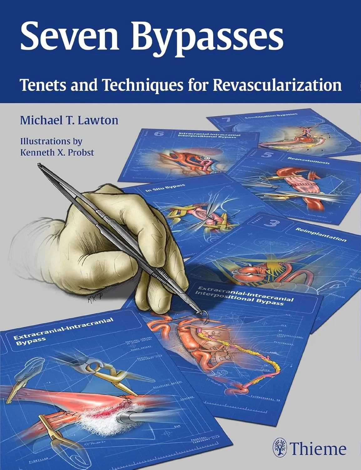 Seven Bypasses Tenets and Techniques for Revasclarization | Hardcover