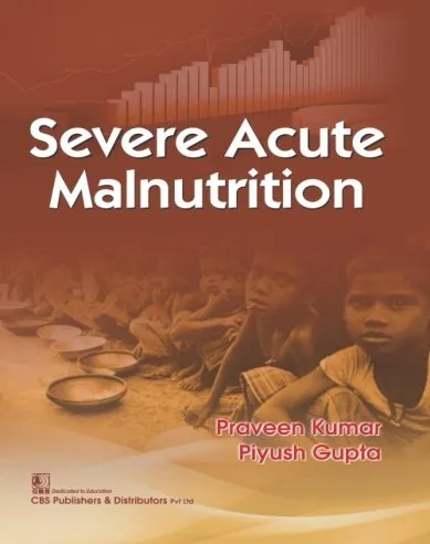 Severe Acute Malnutrition | Paperback