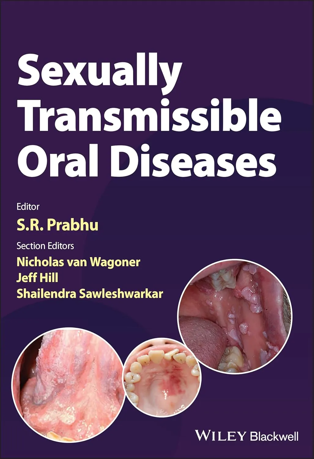 Sexually Transmissible Oral Diseases | Paperback