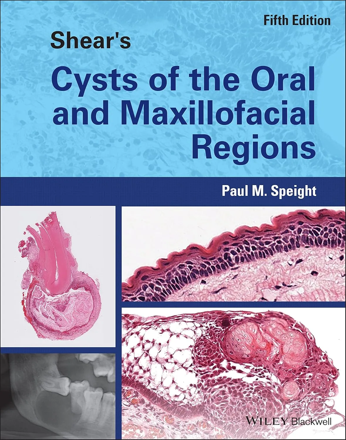Shears Cysts Of The Oral And Maxillofacial Regions 5th Edition | Hardcover