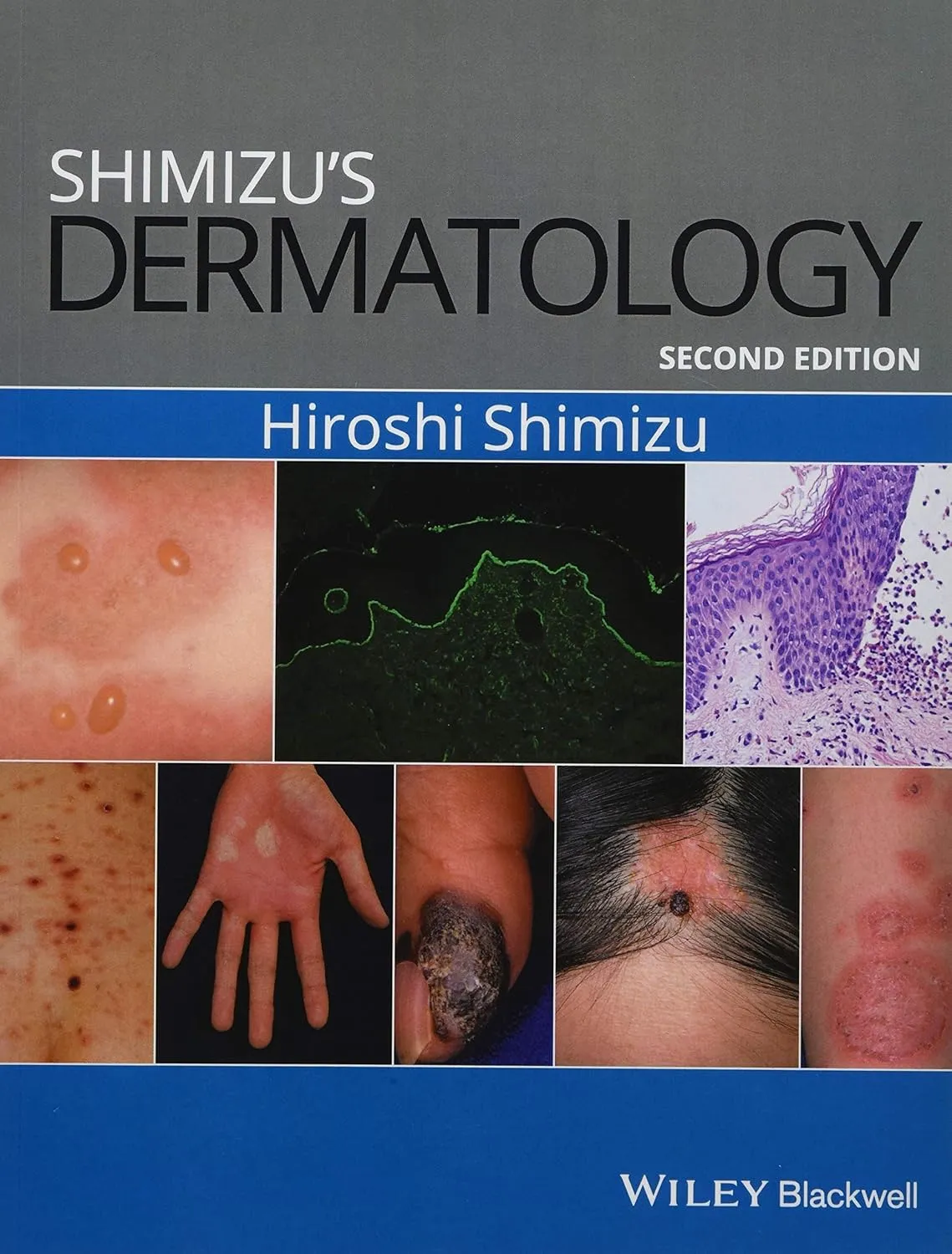 Shimizu's Dermatology | 2nd Edition | Paperback