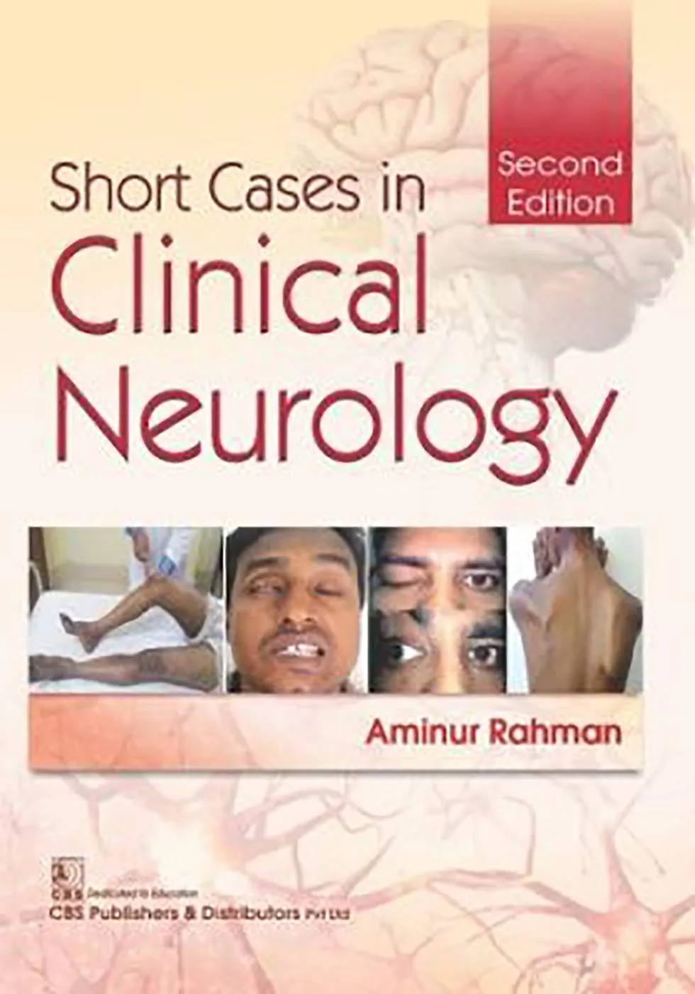 Short Cases in Clinical Neurology | 2nd Edition | Paperback