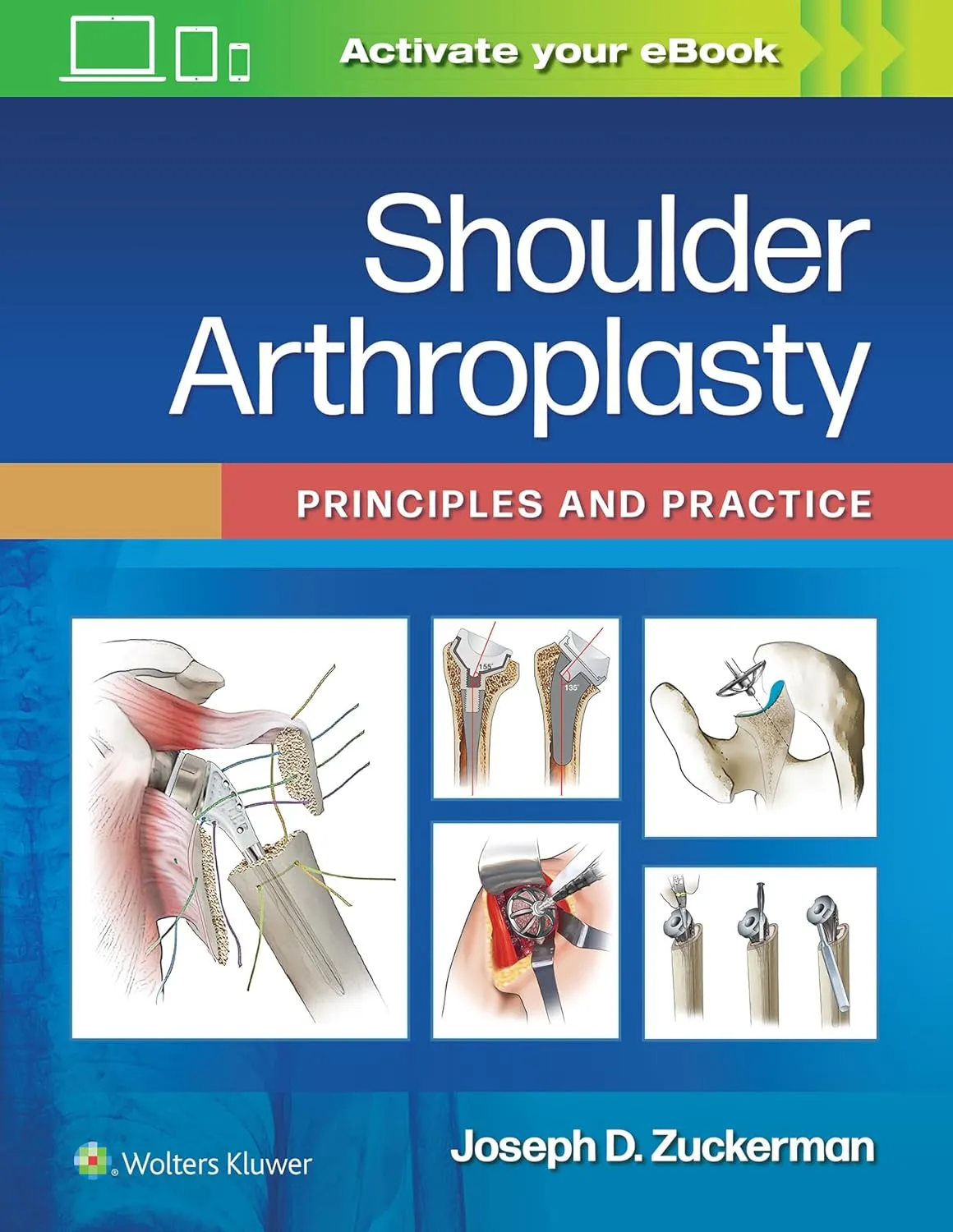Shoulder Arthroplasty Principles And Practice | Hardcover